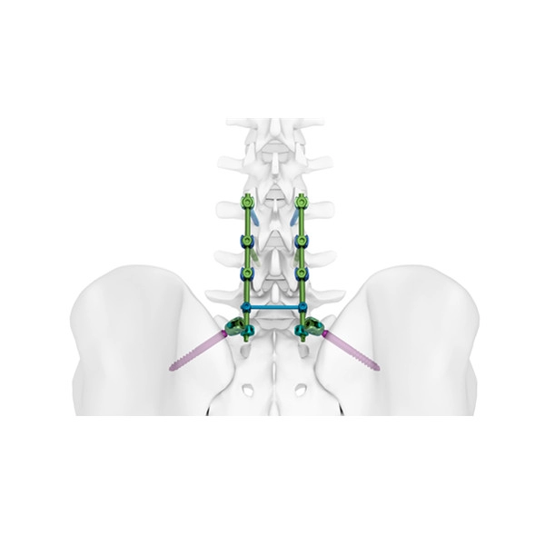 Σύστημα TINA Spine 5.5/6.0