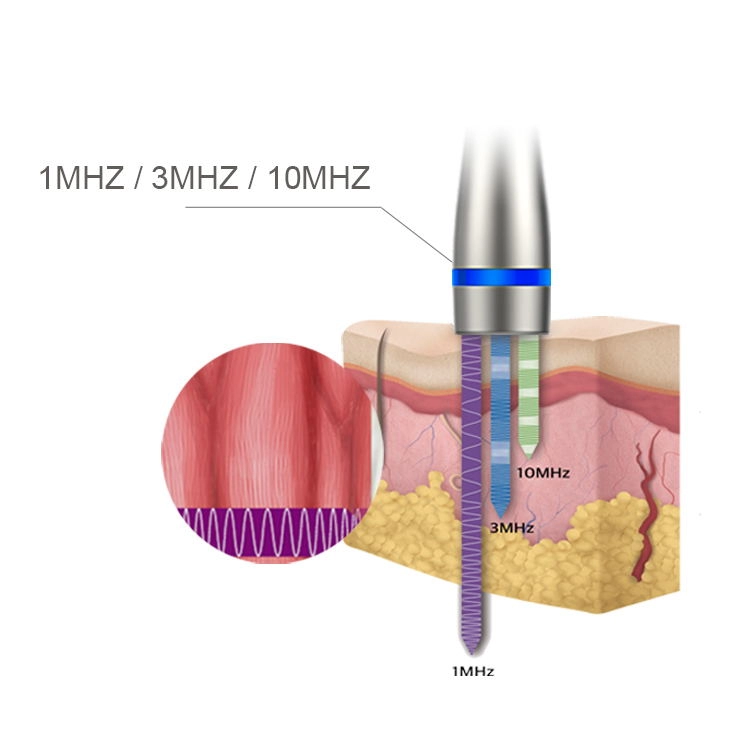 Ultrasound LDM Noblesse 10MHz Therapy 3 in 1 Ultrasonic Sin Wrinkle Remove Beauty Machine Εξοπλισμός περιποίησης προσώπου με κύματα υπερήχων υψηλής συχνότητας