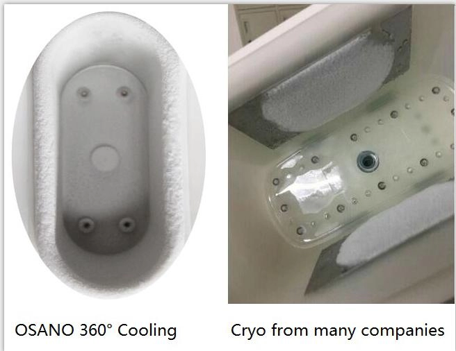 Φορητό Dual Handle Cryo 360° Weight Loss Slimming Machine Cryotherapy Beauty Equipment